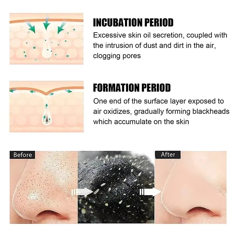 Nose Pore Cleansing Strips