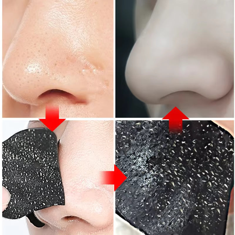 Nose Pore Cleansing Strips